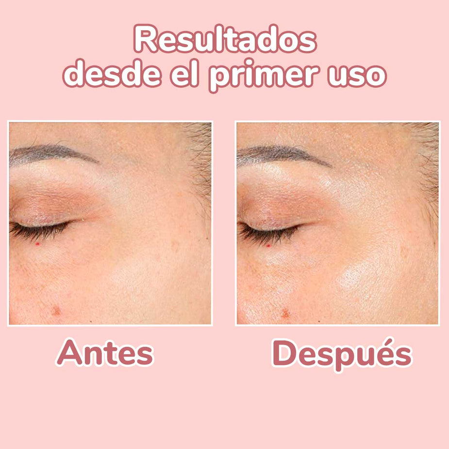 antes-y-despues-super-serum-4-en-1-acala-skin