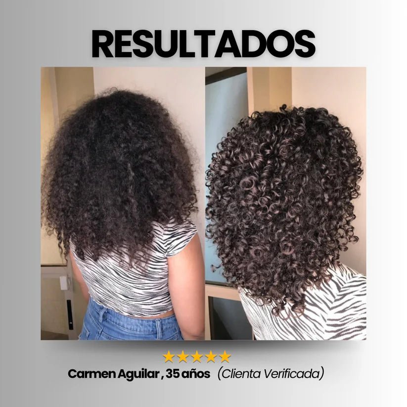 Serum Vitamínico Reparación Cabello 60 Pzas. - Acalaskin - 